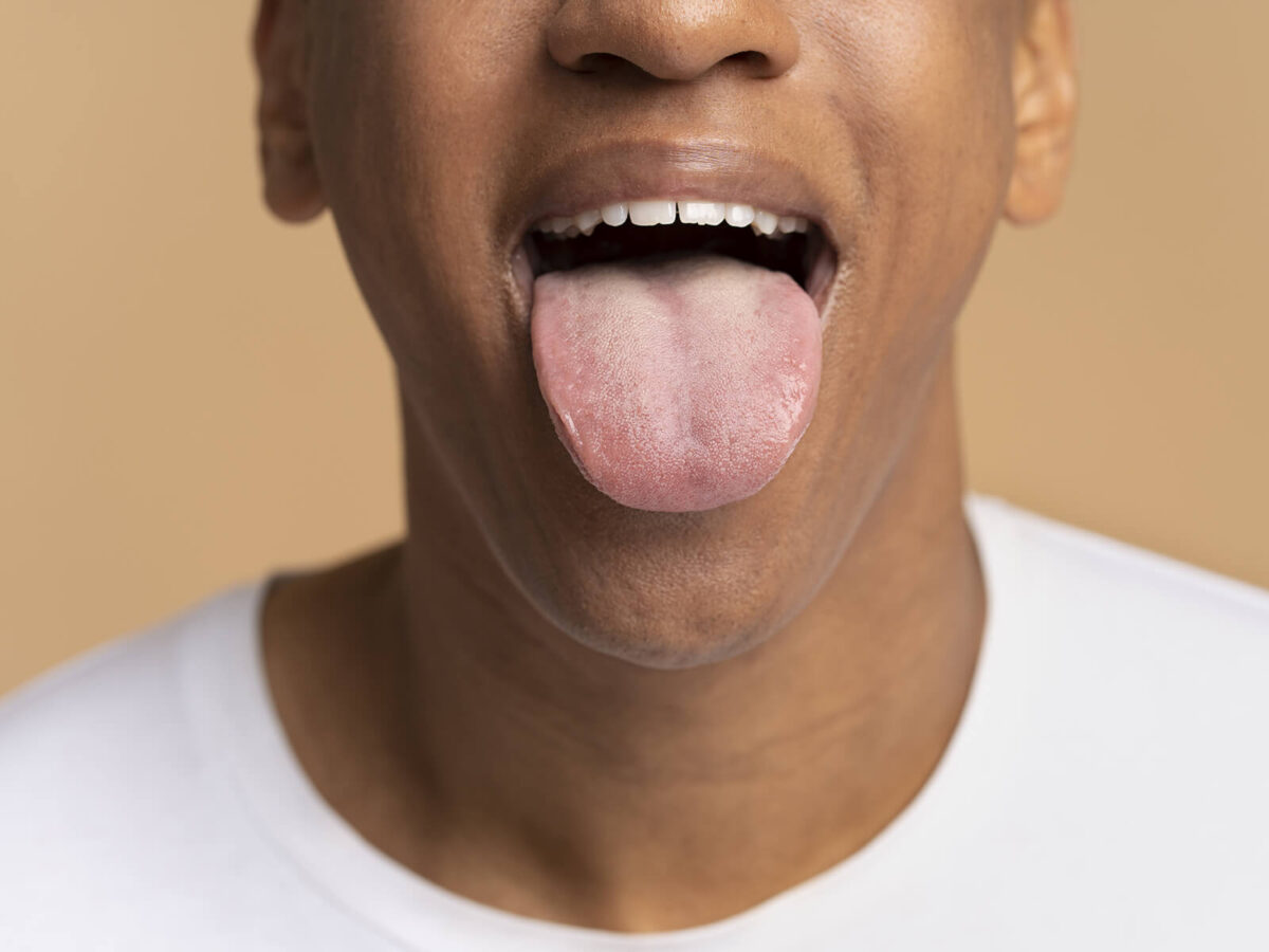 Gray Tongue