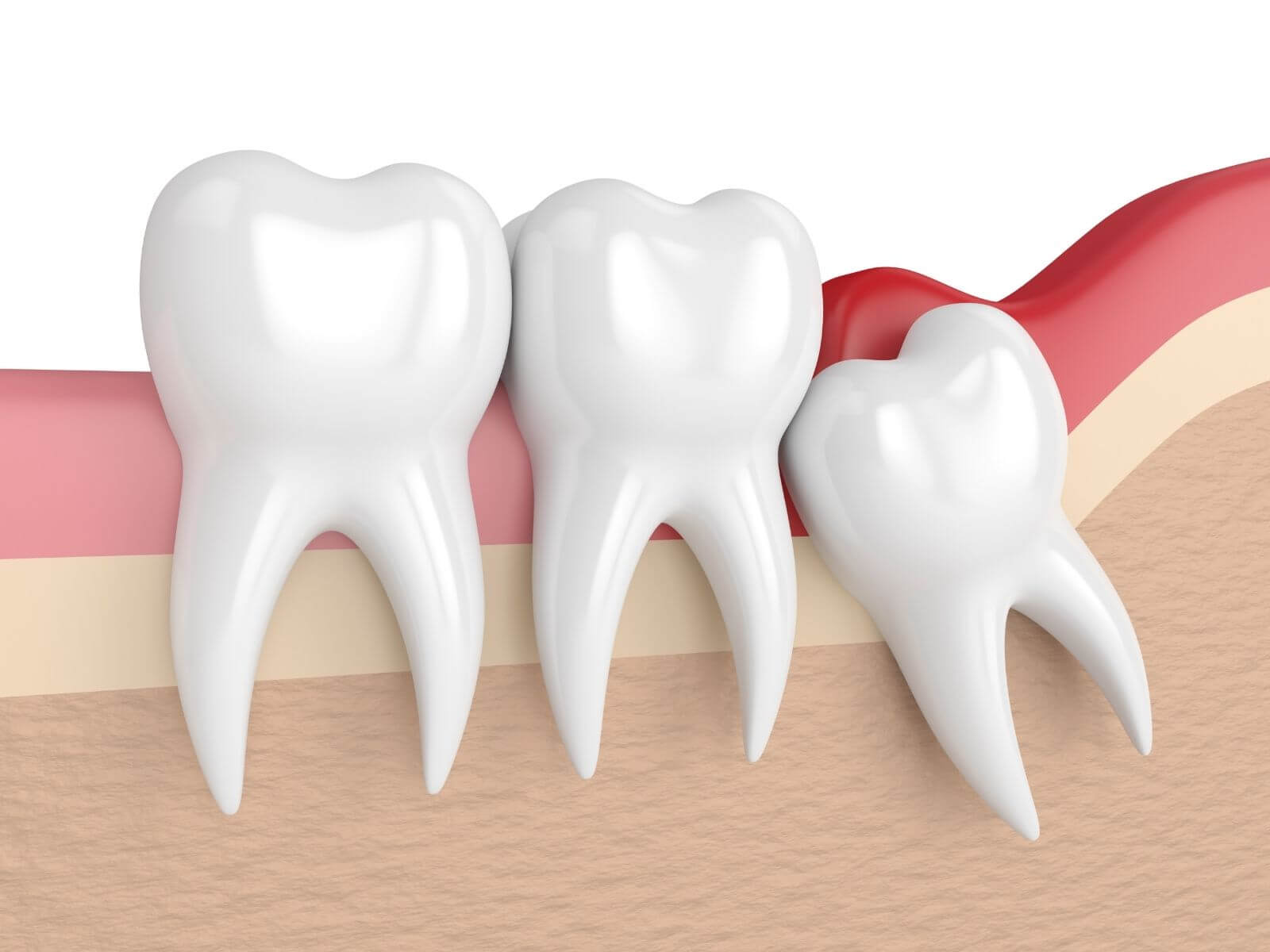 Find Out The Common Signs Of Infection After A Tooth Extraction